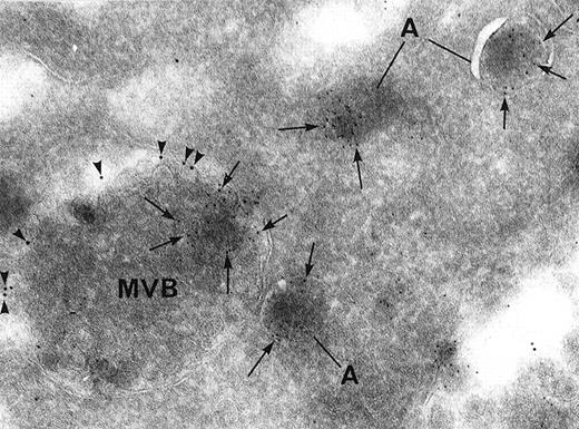 Fig. 3. Double immunolabeling for the dense granule marker granulophysin and the -granule marker von Willebrand factor. / Arrowheads indicate granulophysin (10-nm gold particles), and arrows indicate α-granule marker von Willebrand factor (5-nm gold particles). Both proteins can be found within the same MVB, but they are segregated from each other in distinct microvesicles. Granulophysin is also preferentially associated with the limiting membrane of MVBs. Von Willebrand factor is located in α-granules (A) as well as in MVB microvesicles (original magnification ×67 300).