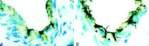 Fig. 1. Immunoperoxidase staining for vWf in control and PAF-treated vessels. / (A) Control (untreated) vessels show granular reaction for vWf in the cytoplasm. In addition, vWf is found associated with the endothelial surface, and little reactivity is noticed at the interendothelial cell junctions. (B) In PAF-treated preparations, there is distinct endothelial cell contraction that is indicative of increased venular permeability. Heavy deposits of vWf are seen on the endothelial cell surface and in the interendothelial cell gaps (arrows). Many cells show almost complete depletion of vWf in the cytoplasm (arrowheads).