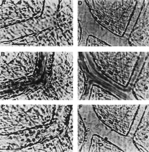 Fig. 3. Videomicrographs showing inhibition of PAF-induced SS RBC adhesion in the ex vivo mesocecum vasculature in the presence of MoAb 7E3 F(ab′)2. / (A-C) Ex vivo preparation treated with OC125 F(ab′)2(control antibody) and PAF: (A) clear venular lumen during artificial perfusion with Ringer-albumin; (B) the passage of SS RBCs after a bolus infusion is accompanied by adhesion of these cells in venules; (C) after the passage of the bolus, a large number of SS RBC are seen adhering to the vessel wall during perfusion with Ringer-albumin. (D-F) Ex vivo preparation treated with MoAb 7E3 and PAF: (D) venules during the artificial perfusion; (E) rapid flow of SS RBCs in the vessels after a bolus infusion; (F) after the passage of the bolus, only few SS RBC adhere to the vessel wall. Visit the article on the website (www.bloodjournal.org) to download the video.