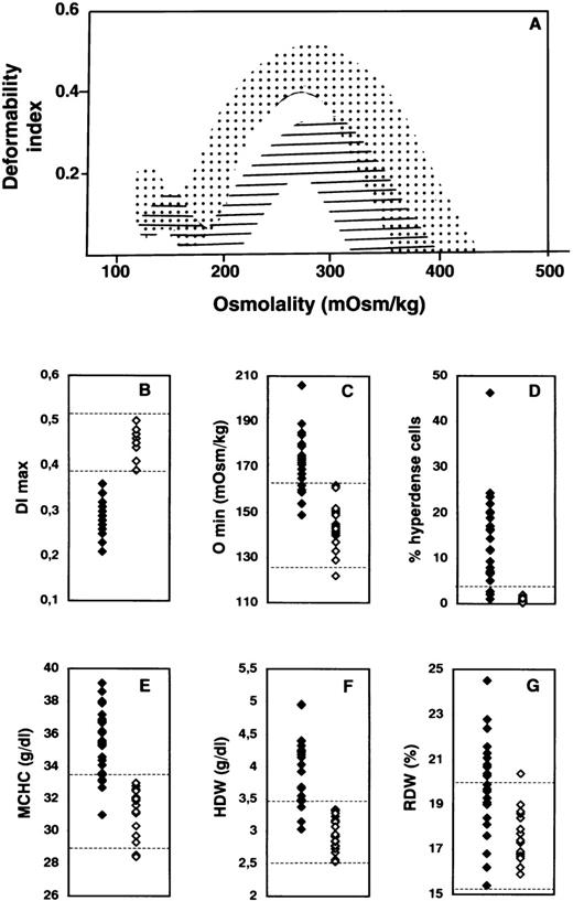 Fig. 1. Hematologic and red cell analyses in hereditary spherocytosis (HS). / (A) Osmotic gradient ektacytometric profiles of blood samples. The deformability profiles of red cells from nonaffected newborns span the dotted area, whereas those of red cells from newborns with HS fall within the hatched area. DImax indicatesmaximum deformability index, a measure of red cell surface area; and Omin, the osmolality at which the deformability value reaches a minimum in the hypotonic region of the gradient, a measure of osmotic fragility of red cells. There is a decrease in DImaxvalues (B) in children with HS, reflecting membrane surface-area loss, and a right shift of the deformability curve in the hypotonic region (Omin), reflecting a decreased ratio of surface area to volume in the HS red cells (increased osmotic fragility) (C). Solid diamonds indicate affected children; and open diamonds, nonaffected children. The percentage of hyperdense cells (cell hemoglobin (Hb) concentration > 410 g/L) (D), mean corpuscular hemoglobin concentration (MCHC) (E), and hemoglobin concentration distribution width (HDW) (F) are higher in HS. In contrast, there is a large overlap between red cell volume distribution width (RDW) in newborns with HS and that in nonaffected newborns (G). The range of normal values in adults and children (B and C) or age-matched newborns (E-G) is indicated by dotted lines. The normal threshold value for percentage of hyperdense cells is indicated by the dotted line in D.
