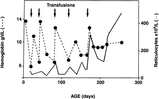 Fig. 3. Temporal evolution of Hb values and reticulocyte counts in a patient with recurrent transfusion-dependent anemia in early infancy. / Arrows indicate transfusions; dotted line, Hb values; and solid line, reticulocyte counts.