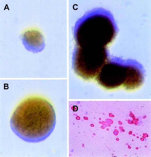 Fig. 7. Erythroid and megakaryocytic progenitors transduced with the MFM vector develop into colonies in the presence of AP1903 alone. / Immediately after transduction with the MFM vector, CD34+ cord blood cells were plated in colony assays with different combinations of drug and cytokines. Displayed in panels A-C are representative BFU-E colonies with the following conditions: (A) BFU-E assays with AP1903 alone; (B) BFU-E assays with AP1903, SCF, and IL-3; (C) BFU-E assays with epo, SCF, and IL-3; and (D) a representative megakaryocytic colony from plasma clot assays plated in AP1903 alone. The cells were stained for CD41 expression, as detailed previously.
