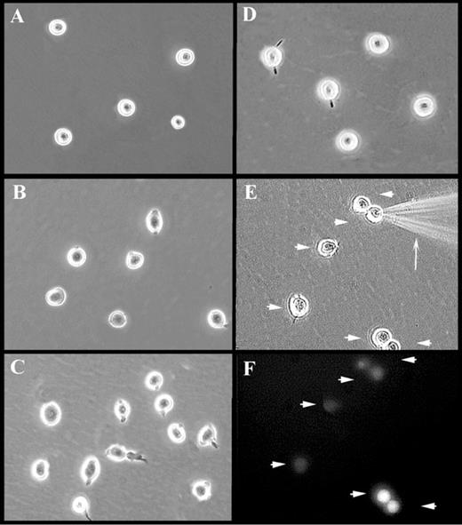 Fig. 1. Photomicrographs of attached and injected CD34+ cells. / Represented are CD34+ cells maintained in suspension (A) or attached to FN-coated dishes in the absence (B) or presence of TS2/16.2.1 mAb (C) or RN-coated dishes (D-F). Injection of attached CD34+ cells is shown in panel E. Note the injection needle (arrow) and cells injected with OG-dextran (arrowheads). A fluorescence micrograph (F) of the identical field shown in panel E demonstrates the successful delivery of fluorescent material (arrowheads). Images in panels E-F were captured from videotape during a live injection session and, therefore, display a decreased resolution, compared with images in panels A-D.