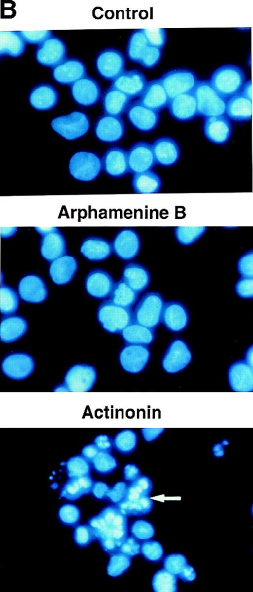Fig. 5. Effect of the inhibition of APN activity on the cell cycle and the induction of apoptosis. / Culture day 7 cells were incubated overnight with or without 10−4 mol/L arphamenine B or actinonin before being examined. (A) DNA content was determined by flow cytometry after ethanol fixation, permeabilization and PI staining: percentages of cells in the G0/G1 or S/G2-M phase, assessed relative to viable cell numbers, are indicated; data are from 1 representative experiment out of 7. (B) Nuclear morphology was visualized by ultraviolet light microscopy after Hoechst 33 342 staining; the arrow shows a typical apoptotic cell; data are from 1 experiment of 3. (C) Surface expression of inner membrane PS was evaluated by flow cytometry after Annexin-V staining: the percentage of cells with increased PS expression is indicated; data are from 1 experiment of 4.
