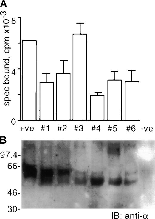 Fig. 3. The soluble GM-CSF receptor is found in plasma conditioned by human hematopoietic progenitor cells. / Plasma conditioned by PBSC products was subjected to Con-A sepharose and ligand affinity column chromatography. Pooled fractions from the ligand affinity column were dialyzed against distilled H2O lyophilized, and then resuspended in 500 μL PBS for analysis. Samples 1, 5, 6 = donors for autologous transplant. Samples 2, 3, 4 = donors for allogeneic transplant. Panel A: 25 μL sample from each donor was used in 125I-GM-CSF solution phase binding assays in the absence or presence of a large excess of unlabeled GM-CSF. Specifically bound radioactivity (spec bound, cpm) was calculated by subtracting the precipitated radioactivity in the absence of unlabeled GM-CSF from that in the presence of unlabeled GM-CSF. Bars represent the mean and SEM of duplicate experiments. Panel B: 30 μL sample from each donor was subjected to 10.5% SDS PAGE under reducing conditions and transferred to PVDF membrane. Immunoblotting was performed with anti-GMRα antibody 8G6. Positive control (+ve) was ligand affinity purified recombinant solGMRα. Negative control (-ve) was sham ligand affinity column eluate. The position of the molecular weight markers is shown in kilodaltons.