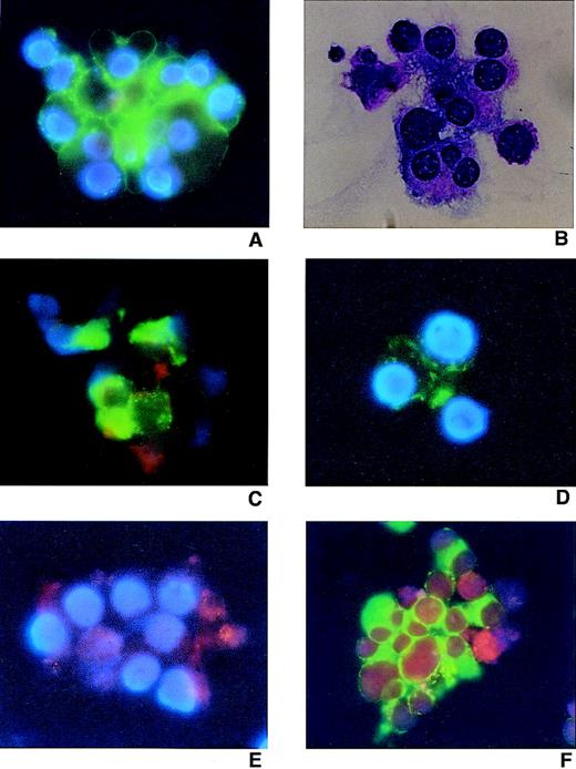 Fig. 2. HCMV infection of megakaryocytes generated in cultures of CD34+ cells challenged with HCMV. / Before initiation of the culture, HCMV was used to infect CD34+ cells that subsequently were allowed to mature to megakaryocytes in the presence of thrombopoietin (TPO). At the end of the culture, HCMV-infected and mock-infected cells (derived from TPO-supplemented cultures) were purified using magnetic beads based on the expression of CD42a antigen after 12 days of culture. Cells were counterstained with DAPI blue nuclear staining and photographed at ×600 magnification. (A) Mock-infected cells stained with fluorescein isothiocyanate (FITC)-conjugated CD42a. (B) Mock-infected cells stained with hematoxylin. (C) HCMV-infected cells stained with CD42a-FITC. (D) Mock-infected cells stained with isotype control antibodies (see “Material and Methods”). (E) HCMV-infected cells stained with biotinylated anti-HCMV pp65 and streptavidin-PE. (F) HCMV-infected cells stained with CD42a-FITC, biotinylated anti-IE mAb, and streptavidin-PE.