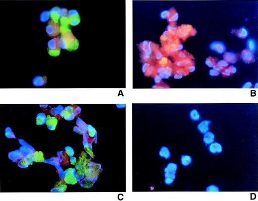 Fig. 5. Infection of mature megakaryocytes with HCMV. / Cultured cells were purified from thrombopoietin-supplemented cultures of CD34+ cells using magnetic beads based on the expression of CD42a antigen after 12 days of culture. Cells were counter-stained with DAPI and photographed at ×600 magnification. (A) HCMV-infected cells. CD42a-FITC versus biotinylated HCMV anti-IE and streptavidin PE. (B) HCMV-infected cells: murine HCMV anti-pp65 IgG2 mAb and antimouse IgG-PE. (C) HCMV-infected cells: CD42a-FITC versus biotinylated HCMV anti-IE and streptavidin PE. (D) HCMV-infected cells: isotype controls.