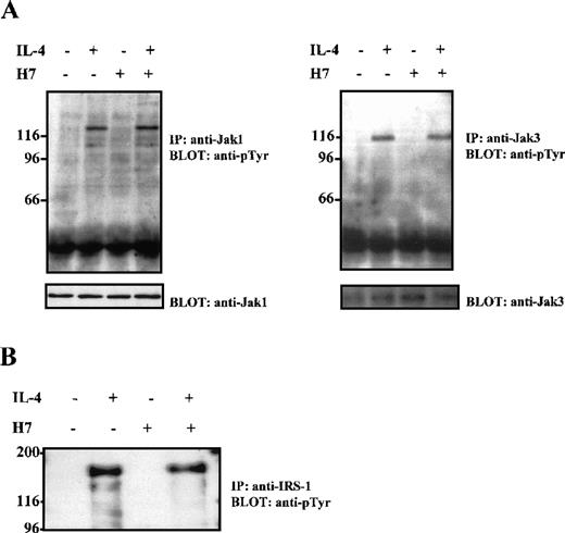 Fig. 2. H7 does not inhibit IL-4-induced Jak1, Jak3, or IRS-1 tyrosine phosphorylation. / Ramos cells were starved O/N and were untreated or treated with H7 (100 μmol/L) for 30 minutes and then were stimulated with IL-4 (100 ng/mL) for 10 minutes as indicated. (A) Jak1 and Jak3 were immunoprecipitated, separated by 7.5% SDS-PAGE, and immunoblotted with anti-phosphotyrosine antibody. Shown in the lower panel are protein levels from the same filters blotted again with anti-Jak1 and anti-Jak3. (B) Ramos cells treated as in (A), but immunoprecipitation was carried out with anti-IRS-1 antibody before anti-phosphotyrosine immunoblotting.