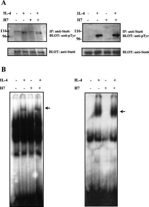 Fig. 3. Effect of H7 on IL-4-induced Stat6 tyrosine phosphorylation and DNA binding. / (A) HepG2 (left) and Ramos cells (right) were untreated or treated with H7 (100 μmol/L) for 30 minutes and then stimulated with IL-4 (100 ng/mL) for 10 minutes as indicated. Stat6 was immunoprecipitated and separated by 7.5% SDS-PAGE and was subjected to anti-phosphotyrosine immunoblotting. Shown in the lower panel are protein levels after anti-Stat6 reblotting. (B) Lysates from Ramos cells (left) and COS-7 cells transfected with Stat6 (right), treatments as in (A), and nuclear lysates were analyzed in the mobility shift assay using32P-labeled Igε oligonucleotide. The Stat6 binding complex is indicated with an arrow.