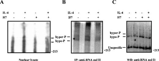 Fig. 8. IL-4-induced phosphorylation of RNA polymerase II in vivo is inhibited by H7. / 32P-orthophosphate-labeled Ramos cells were left untreated or were pretreated with H7 (100 μmol/L) for 30 minutes and stimulated with IL-4 (100 ng/mL) for 15 minutes, as indicated. (A) Nuclear extracts (10 μg) were separated on 5% SDS-PAGE and transferred to PVDF membrane. Autoradiography of the membrane: hypophosphorylated (hypo-P) and hyperphosphorylated (hyper-P) forms of RNA polymerase II are indicated. (B) RNA polymerase II was immunoprecipitated from32P-orthophosphate-labeled Ramos cells and separated on SDS-PAGE before autoradiography. (C) 50 μg nuclear lysates from unlabeled Ramos cells were electrophoresed on SDS-PAGE, transferred to PVDF membrane, and subjected to immunoblotting with anti-RNA polymerase II antiserum.