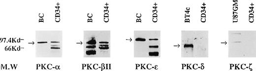 Fig. 1. Protein expression of different PKC isoforms in freshly isolated CD34+ progenitor cells from bone marrow. / B cells (BC) and the glioma cell lines BT4c and U87GM were included as positive controls. The CD34+ cells were selected as described in “Materials and Methods,” and cytosolic proteins were prepared and analyzed by Western blotting. A representative of 3 separate experiments is shown. Note that for B cells and CD34+ cells, the bands below 80 kd for PKC-α, PKC-β2, and PKC-ε were possible degradation products resulting from activation.