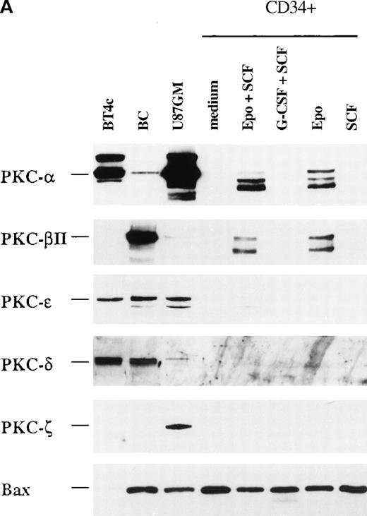 Fig. 2. Protein expression of different PKC isoforms in CD34+ progenitor cells cultured with different cytokines. / CD34+ cells were cultured in vitro for 4 days in medium alone or in the presence of EPO (5 U/mL) and SCF (50 ng/mL), G-CSF (50 ng/mL) and SCF (50 ng/mL), EPO (5 U/mL), or SCF (50 ng/mL) before the preparation of cytosolic proteins. Relative protein expressions of PKC-α, PKC-β2, PKC-γ, PKC-δ, PKC-ε, PKC-ζ, and Bax were determined by Western blotting. (A) One representative blot is shown. Note that for BT4c and U87GM, the upper band for PKC-α is possibly a phosphorylated form. (B) Optical density of PKC-α, determined by densitometric imaging of hyperfilms, is shown. Mean ± SEM of 5 to 12 separate experiments (*P < .001, n = 12;P = .009, n = 5). The expected 80-kd band is used for quantitation. (C) Optical density of PKC-β2, determined by densitometric imaging of hyperfilms, is shown. Mean ± SEM of 5 to 8 separate experiments (*P = .046, n = 5).