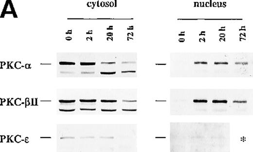 Fig. 4. Protein expression of PKC-, PKC-β2, and PKC-ɛ in cytosolic and nuclear fraction of CD34+ cells during EPO stimulation for various times. / CD34+ cells were cultured in medium alone for 24 hours before the addition of EPO (5 U/mL) and then were incubated for various times before cytosolic and nuclear proteins were prepared. The protein expression of PKC-α, PKC-β2, and PKC-ε was determined by Western blotting. (A) A representative of 5 separate experiments is shown. *, not performed. (B) Optical density of PKC-α determined by densitometric imaging of hyperfilms is shown. Mean ± SEM of 5 separate experiments (*P = .028, n = 5). (C) Optical density of PKC-β2 determined by densitometric imaging of hyperfilms is shown. Mean ± SEM of 5 separate experiments (*P = .047, n = 5). (D) Optical density of PKC-ε determined by densitometric imaging of hyperfilms is shown. Mean ± SEM of 3 separate experiments.