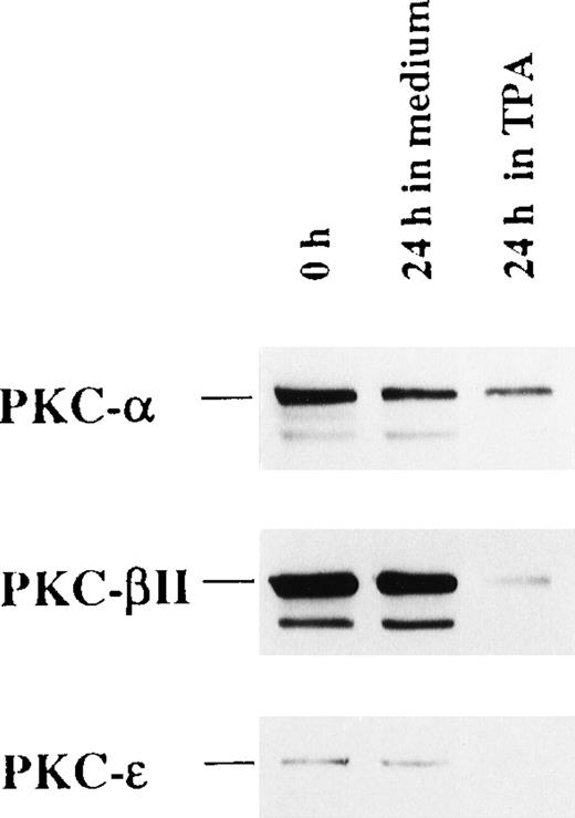 Fig. 6. TPA treatment of CD34+ cells down-regulate the expression of PKC-, PKC-β2, and PKC-ɛ. / CD34+ cells were cultured in medium alone or in the presence of 100 nmol/L TPA for 24 hours. Then cytosolic proteins were prepared, and the expression of PKC-α, PKC-β2, and PKC-ε was analyzed by Western blotting.