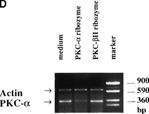 Fig. 8. The effect of PKC- and PKC-β2 ribozymes on CD34+ cells cultured with EPO and SCF. / The CD34+ cells were incubated at 30 000 cells/well in flat-bottomed, 96 well plates with PKC-α ribozyme (2 μmol/L), PKC-β2 ribozyme (2 μmol/L), or medium for 24 hours and then stimulated with EPO (5 U/mL) and SCF (50 ng/mL.). (A) Cells were stained with the indicated mAbs 8 days after transfection with ribozymes. (B) Cytosolic proteins were prepared from cells cultured for 6 days after transfection. (C) Cytosolic proteins were prepared from cells cultured for 6 days after transfection. Control cells were transfected with a PKC-ε ribozyme that was not catalytic active. (D) RT-PCR was performed on RNA prepared from cells cultured for 6 days after transfection. PKC-α, 320 bp; actin, 620 bp.