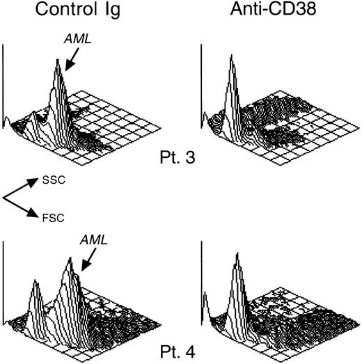 Fig. 3. CD38 ligation inhibits in vitro growth of patient-derived leukemic myeloid cells. / AML blast cells from 2 patients (patients 3 and 4 in Table 1) were cultured for 7 days on allogeneic bone marrow stromal layers in the presence of anti-CD38 (T16) or of a control nonreactive Ig. Isometric contour plots depict the cells' light scattering (FSC, forward scatter; SSC, side scatter) after culture. In cultures with control Ig, most cells had light-scattering properties of viable myeloblasts. These cells also expressed CD13 and/or CD33 (not shown). Myeloblast cell recovery was drastically reduced in cultures with anti-CD38, where most residual viable cells had lymphoid morphology, and lacked CD13 and CD33 (not shown).
