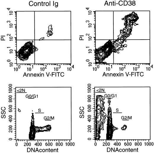 Fig. 4. Ligation of CD38 induces apoptosis in AML cells. / Leukemic myeloblasts (patient 3 in Table 1) were cultured for 48 hours on allogeneic bone marrow stromal layers in the presence of anti-CD38 (T16) or of a control nonreactive Ig. Top panels are flow cytometric contour plots illustrating staining with Annexin-V (x-axis; a marker of apoptosis) and propidium iodide (PI, y-axis; a marker of cell membrane permeability) after culture. Bottom panels illustrate DNA content analysis; a marked increase in hypodiploid (< 2N) cells, characteristic of apoptosis, is seen in cultures containing anti-CD38. Among the viable cells, the percentage of cells in G0/G1, S, and G2/M was 90%, 8%, and 2% with control Ig, and 95%, 4%, and 1% with anti-CD38, respectively.