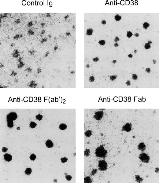 Fig. 5. CD38 ligation induces aggregation of murine 32D cells tranfected with human CD38. / Cultures of 32D expressing human CD38 were exposed for 24 hours to a nonreactive isotype-matched control Ig or to 3 preparations of anti-CD38 (THB7): whole Ig molecule, F(ab′)2fragments, and Fab fragments. Cell aggregation was induced by anti-CD38 irrespective of the integrity of the Ig molecule. The loose aggregation seen with control Ig was also seen in cells cultured without antibody (not shown).