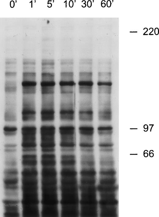 Fig. 7. CD38 ligation in 32D cells expressing human CD38 induces tyrosine kinase activity. / 32D cells were exposed to anti-CD38 (T16) for the times indicated. Cell lysates were separated by SDS-PAGE and transferred to a nitrocellulose membrane, which was probed with the anti-phosphotyrosine antibody 4G10. Molecular mass markers (in kDa) are indicated.
