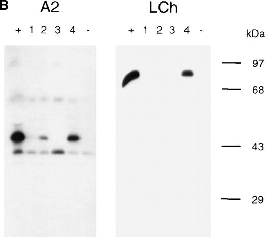 Fig. 1. Characterization of anti-FVIII antibodies in the plasma of a patient. / Binding of antibodies to metabolically labeled FVIII fragments corresponding to the FVIII heavy chain (HCh), the A2 domain (A2), the FVIII light chain (LCh), and the C2 domain (C2) was evaluated by immunoprecipitation. (A) Reactivity of anti-FVIII antibodies in the patient's plasma. (lane 1, +) Positive control. mAb CLB-CAg 9 for HCh and A2, mAb CLB-CAg 117 for LCh and C2. (lane 2, −) Control plasma. (lane 3, P) Antibodies in the patient's plasma. (B) Subclass typing of anti-FVIII antibodies. (left panel, A2) Anti-A2 domain antibodies. (right panel, LCh) FVIII light-chain–specific antibodies. (lane 1, +) Total IgG. (lanes 2-5)1-4 IgG1, IgG2, IgG3, IgG4. (lane 6, −) Control plasma. In the patient's plasma no anti-FVIII antibodies of the IgM class could be detected (data not shown). Molecular weight markers are indicated at the right of the figures.