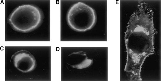 Fig. 6. Confocal microscopy after indirect immunofluorescent staining with monoclonal anti-TM antibody and secondary FITC-labeled antibody. / Cells transfected with plasmid pRSVSVOTMwt, show a high concentration of the TM-anti-TM complexes in the plasma membrane (A, B). In contrast, cells transfected with plasmid pRSVSVOTMmut show a much reduced membrane incorporation of the TM antigen and a high juxtanuclear staining (C-E). Panel E represents an enlarged photograph of a cell expressing the mutant insT 1689.
