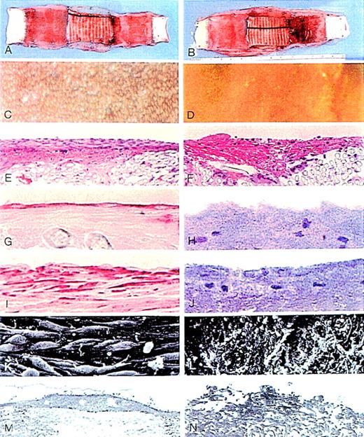 Fig. 2. Comparisons of representative seeded and control grafts. / Panels on left show seeded grafts, and panels on right, control grafts. (A,B) Gross specimens. (C,D) Silver nitrate-stained flow surfaces (×85). (E,F) Hematoxylin and eosin stain (×145). (G,H) CD34 stain (×580). (I,J) Smooth muscle α-actin stain (×560). (K,L) Scanning electron microscopy (×1000). (M,N) Transmission electron microscopy (×5400).