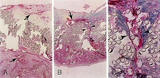Fig. 3. Antibodies to endothelial cell CD34 stain delineate the enhanced microvessel formation in seeded grafts. / (A) Inside the neointima and external space of the graft (×75). (B) Microvessel (arrow) and representative view of continuous linear staining pattern of a microvessel traversing the graft wall (arrowheads) (×75). (C) Enlargement of area in B (arrowheads) (×300).