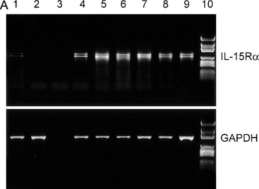 Fig. 1. RT-PCR and flow cytometric analyses of IL-15R, IL-2R, and control GAPDH. / (A) RT-PCR analysis of expression of IL-15Rα (upper) and control GAPDH (lower) in myeloma cell lines. The results indicated that all myeloma cell lines expressed the mRNA of IL-15Rα (778 bp) in 2 alternatively spliced isoforms. Lane 1: PBMC from a healthy donor as positive control; lane 2: erythrocytes from a healthy donor as negative control; lane 3: dH2O as technical negative control; lane 4: RPMI 8226; lane 5: OPM-2; lane 6: MC-Car; lane 7: LP-1; lane 8: IM-9; lane 9: ARH-77; and lane 10: the molecular weight marker pGEM (Promega). (B) Flow cytometric analysis of all constituents of the IL-15R and the IL-2R in RPMI 8226 cells. Cells were stained with antibodies specific for the relevant subunits of the receptors or the respective isotype-matched control mAb. Fluorescence intensities (FI) were determined by flow cytometry. Each histogram represents 3 independent measurements.