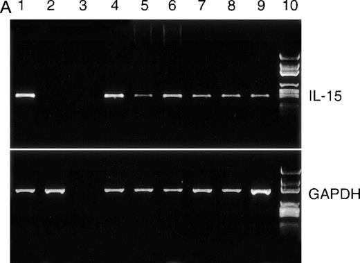 Fig. 2. RT-PCR analysis of IL-15 and control GAPDH, with expression in myeloma cell lines. / (A) RT-PCR analysis of expression of IL-15 (upper) and control GAPDH (lower) in myeloma cell lines. All myeloma cell lines expressed the mRNA of IL-15 (357 bp). Lane 1: PBMC from a healthy donor as positive control; lane 2: erythrocytes from a healthy donor as negative control; lane 3: dH2O as technical negative control; lane 4: RPMI 8226; lane 5: OPM-2; lane 6: MC-Car; lane 7: LP-1; lane 8: IM-9; lane 9: ARH-77; and lane 10: the molecular weight marker pGEM (Promega). (B) Expression of intracellular IL-15 protein in myeloma cell lines and in the plasma cell fraction of myeloma patients. Cells were stained with a specific anti–IL-15 mAb (solid line) or the respective isotype-matched control mAb (dashed line), and FI were determined by flow cytometry. Representative histograms of the cell lines for 1 of 3 independent measurements are presented. Staining profiles representative for IL-15 protein-negative (Pat. #4) and for IL-15 protein-positive primary myeloma cells (Pat. #13) are shown.