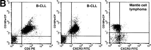 Fig. 2. CXCR3 and Mig expression in low-grade B-cell lymphomas. / (A) Immunohistochemical detection on paraffin-embedded and cryostat sections using the 1C6/CXCR3 and 4G10/Mig monoclonal antibodies. Abbreviations: H&E, hematoxylin and eosin staining; CLL, nodal involvement by B-cell chronic lymphocytic leukemia; MCL, mantle cell lymphoma; FL, follicular lymphoma; SMZL, splenic marginal zone lymphoma. (B) Flow cytometric detection of CXCR3 in a representative case of B-CLL (3-color CD19/CD5/CXCR3 staining in panels 1 and 2) and mantle cell lymphoma (panel 3). Cytograms represent all cells in the sample within the lymphocyte gate.