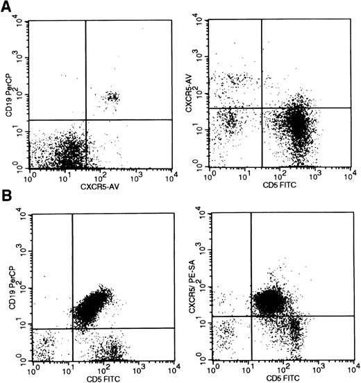 Fig. 4. BLR1/CXCR5 expression in B-cell chronic lymphocytic leukemia. / (A) BLR1/CXCR5 expression in peripheral blood of both CD19-positive B cells (left) and a subset of CD5-positive T cells (right). (B) BLR1/CXCR5 coexpression in the CD19/CD5-positive tumor cells of B-CLL. Flow cytometric detection used the 51505.111 CXCR5 monoclonal antibody with gating on the lymphocyte population by forward and side scatter properties.