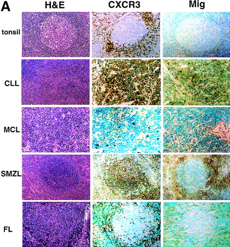 Fig. 2. CXCR3 and Mig expression in low-grade B-cell lymphomas. / (A) Immunohistochemical detection on paraffin-embedded and cryostat sections using the 1C6/CXCR3 and 4G10/Mig monoclonal antibodies. Abbreviations: H&E, hematoxylin and eosin staining; CLL, nodal involvement by B-cell chronic lymphocytic leukemia; MCL, mantle cell lymphoma; FL, follicular lymphoma; SMZL, splenic marginal zone lymphoma. (B) Flow cytometric detection of CXCR3 in a representative case of B-CLL (3-color CD19/CD5/CXCR3 staining in panels 1 and 2) and mantle cell lymphoma (panel 3). Cytograms represent all cells in the sample within the lymphocyte gate.