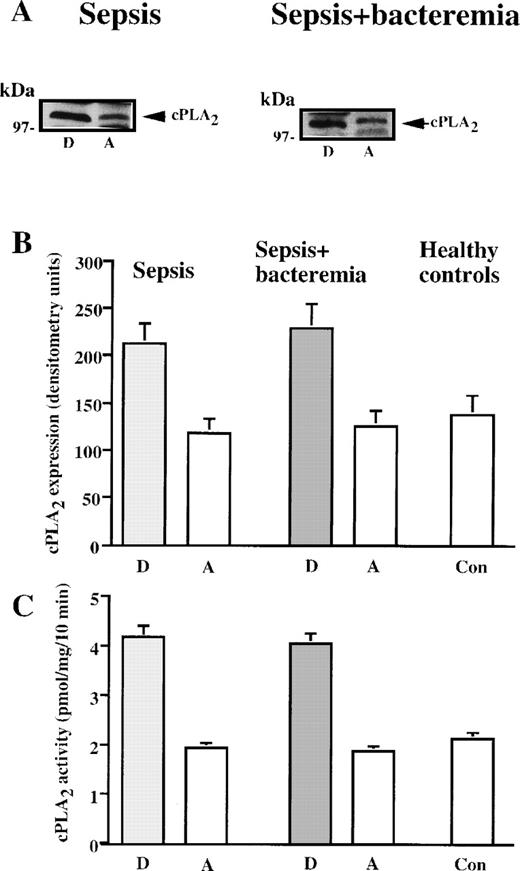 Fig. 2. CPLA2 in neutrophils during sepsis and after recovery. / (A) Immunoblot analysis of cPLA2 in neutrophil lysates of septic patients during infection and after recovery. Shown are the results of a representative patient with sepsis and a representative patient with sepsis+bacteremia during the disease (“D”) and after complete recovery (“A”). (B) cPLA2 expression in human neutrophils during sepsis and after recovery (expressed in densitometry units). The mean ± SEM of the densitometry values in the septic patients who showed increased cPLA2 activity and the controls are shown. (C) cPLA2 activity in neutrophil lysates during sepsis and after recovery. The mean ± SEM of cPLA2 activities in neutrophil of the individual patients who showed increased cPLA2 activity (Figure 1) and of the controls are shown.