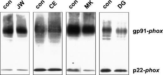 Fig. 1. Western blot of neutrophil plasma membranes. / Plasma membranes (2 μg) were run on a 10% polyacrylamide minigel and blotted onto nitrocellulose. The blot was stained for gp91-phoxand p22-phox with mAbs 48 and 449, respectively, as previously described. The patients are indicated above the lanes. For each patient, material of a control donor was processed in parallel.