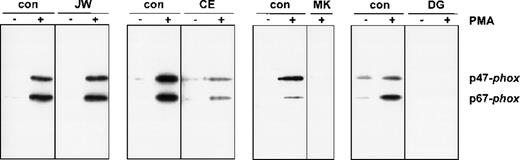Fig. 3. Western blot analysis of plasma membranes of activated neutrophils. / Cells (20 × 106) were incubated with PMA (100 ng/mL) or without PMA for 10 minutes at 37°C. Fractionation of the cells was performed as previously described. PAGE (10%) was performed for the plasma membranes with comparable amounts of cytochrome b558. The blot was stained with rabbit antisera against p47-phox and p67-phox. The patients are indicated above the lanes. For each patient, material of a control donor was processed in parallel. The treatment (−PMA or +PMA) is also indicated above the lanes. From patient MK, we did not obtain enough neutrophils to investigate the unstimulated cells; therefore, only the +PMA lane is shown.