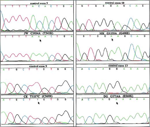 Fig. 2. Analysis of genomic DNA from both the patients and a healthy control. / PCR products from each exon with intron boundaries and from the promoter region of CYBB were generated from genomic DNA obtained from circulating leukocytes and were analyzed by dye primer cycle sequencing. The figure shows the areas in which mutations were found in the patients. Patients are indicated by initials, nucleotide substitutions, and amino acid substitutions. Above each patient sequence, the normal sequence from the control is shown. Arrows indicate mutant sequence.