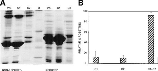 Fig. 2. At least 2 serum components are required for rosette formation, as demonstrated using conA affinity chromatography. / (A) SDS-PAGE profile of fractions eluted from a conA–Sepharose affinity column. Aliquots of whole serum (WS) and conA-unbound (C1) and conA-bound, eluted (C2) fractions (up to 20 μg protein, corresponding to the same relative amount of each fraction) were resolved by SDS-PAGE (10% acrylamide) in the absence (nonreduced) or presence (reduced) of 0.1 mol/L dithiothreitol. The gel was stained with Coomassie brilliant blue. Molecular mass markers (M) are 30, 46, 66, 97, and 220 kd from bottom to top, respectively. (B) Effect of the conA fractions on rosette formation. The rosetting assay was conducted as described in the legend to Figure 1, and the fractions were used at 10% (vol/vol) each, for all experiments. Two different batches of serum were fractionated, and the assay was conducted in duplicate for each batch (mean ± SD for 4 experiments).