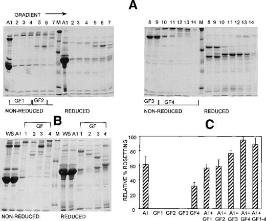 Fig. 4. At least 2 serum components are involved in rosette formation, as demonstrated using anion exchange chromatography. / SDS-PAGE profile of fractions eluted from a Sepharose Q anion exchange column. Aliquots of the unbound fraction (A1) and gradient fractions (GF) before (A) and after (B) pooling and concentration (aliquots of up to 10 μg protein, corresponding to 10 times more gradient fraction than the WS and A1 fractions), were resolved by SDS-PAGE (10% acrylamide) as described in the legend to Figure 2. (C) Effect of the fractions on rosette formation. The rosetting assay was conducted as described in the legend to Figure 1, and the fractions were used at 15% (vol/vol) of A1 and 10% (vol/vol) of GF1-4 for all experiments. Two different batches of serum were fractionated, and the assay was conducted in duplicate for each batch (mean ± SD for 4 experiments).