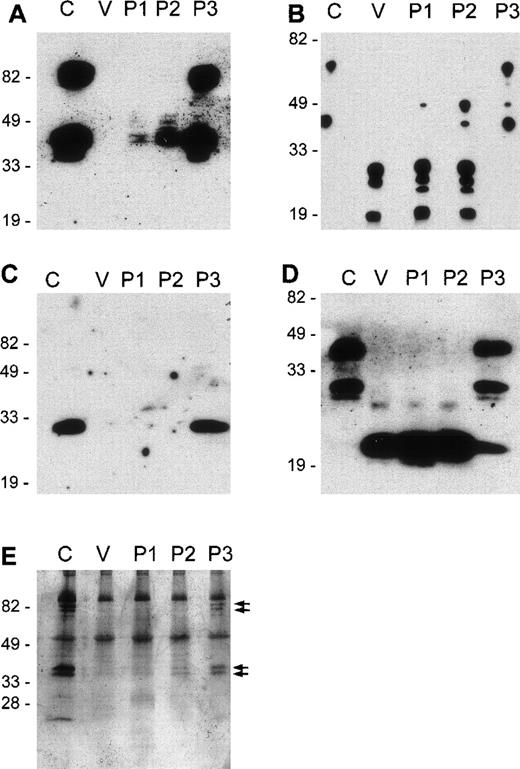 Fig. 3. Cleavage fragments of GPA, GPB, and GPC remain on E ghosts after treatment with L. intermedia venom toxins. / E were treated with VBS2+ (C) or with 10 μg/mL of L. intermedia venom (V) or purified toxins P1, P2, or P3. E ghosts were prepared and run on 12% SDS-PAGE under nonreducing conditions (A to D) or were stained with silver (E). Western blots: A, GPA extracellular epitope; B, GPA intracellular epitope; C, GPB extracellular epitope; D, GPC intracellular epitope.