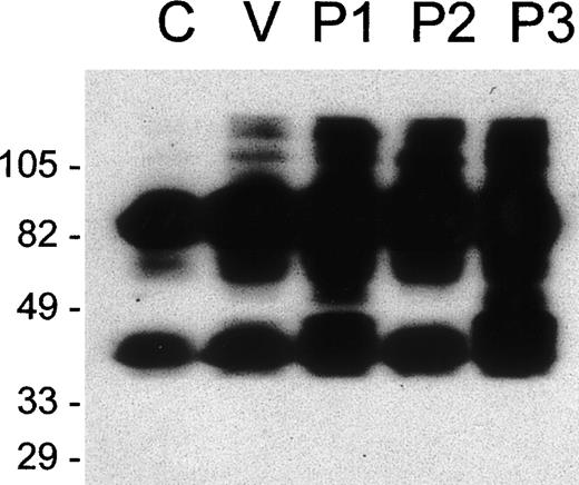 Fig. 4. Loxosceles venom and purified toxins do not cleave purified glycophorin A. / Purified GPA (2 μg) was incubated with buffer (C) or with 2 μg ofL. intermedia venom (V), P1, P2, or P3 toxins for 60 minutes at 37°C. Samples were separated by SDS-PAGE under nonreducing conditions (12% gel) and analyzed by Western blot using the monoclonal antibody Bric163 .