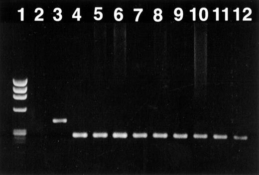Fig. 4. Engraftment of donor bone marrow in the B10.D2 → BALB/c transplant documented by polymerase chain reaction amplification of a polymorphic microsatellite region within the IL-1β gene. / Long-term engraftment of allogeneic bone marrow was found in all transplanted mice. This figure demonstrates a representative analysis of an ethidium bromide-stained 1.5% agarose gel. (lane 1) DNA marker φ × 174 digested with Hae III (marker sizes 1353, 1078, 872, 603, 310, 281 and 271, and 243, 194 bp; GIBCO BRL). (lane 2) Negative control (PCR without DNA). (lane 3) Recipient (BALB/c) standard. (lane 4) Donor (B10.D2) standard. (lanes 5–8) Recipients given PG27 (ID nos. 602, 604, 2011, 2012). (lanes 9–12) Recipients given solvent control (ID nos. 606, 610, 2006, 2007).