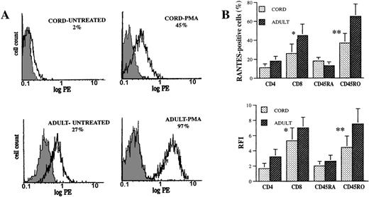 Fig. 2. Intracellular RANTES expression in CBL and ABL. / CBL and ABL were either untreated or stimulated with PMA (5 ng/mL) for 12 hours, after which staining for RANTES and the cell-surface markers CD4, CD8, CD45RA, and CD45RO was performed as previously described. (A) Flow cytometric RANTES expression in CBL and ABL. The shaded histograms represent control staining with irrelevant mAb, and the open histograms represent cells staining positive for RANTES. Percentages of cells staining positive for RANTES are shown. (B) RANTES expression in lymphocyte subsets (2-color flow cytometry). Results (mean ± SEM) are shown as percentages of cells in each subset expressing RANTES and as relative fluorescence intensity (RFI = mean fluorescence intensity of sample minus mean fluorescence intensity of control/mean fluorescence intensity of control). The results are representative of 6 pairs of cord and adult blood specimens. *Indicates CD8 versus CD4, P < .05. **Indicates CD45RO versus CD45RA, P < .05.