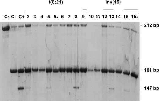 Fig. 1. HinfI assay for detection of Asp816Val c-kit mutation. / Digestion of the 212 bp exon 17 polymerase chain reaction (PCR) product gives rise to a 161 bp DNA fragment r: when an A-T transition is present, an additional HinfI site is created leading to a 147 bp DNA fragment. This additional fragment was present in patients 2, 5, 8, 13 and 15 as well as in a patient with systemic mastocytosis included as positive control (lane C+). The negative controls were undigested (lane C0) and digested (lane C−) DNAs from normal subjects. Molecular assay at follow up (5a and 15a) is also shown for patients 5 and 15.