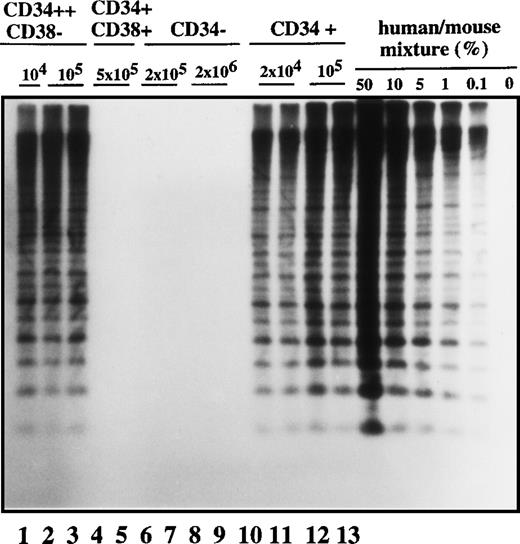 Fig. 1. Human cell engraftment with selected Ph1-ALL cells according to CD34 and CD38 expression in the bone marrow of NOD/SCID mice. / Mice were implanted with the indicated number of purified cells (CD34+, CD34−, CD34++CD38−, or CD34+CD38+, respectively) from patient No. 2, and 4-6 weeks later, human cell engraftment was estimated by Southern blot analysis and then inferred from the intensity of the characteristic 2.7 kb band.19 Each mouse was analyzed independently using this strategy. This experiment is representative of 3 independent experiments.