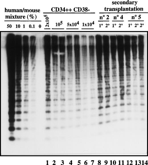 Fig. 3. Transplantation of SL-ICs into secondary recipients. / Lanes 1-7: CD34++CD38− leukemic cells from patient No. 6 were injected at the indicated doses into NOD/SCID mice. After 6-8 weeks, these mice were sacrificed, and the percentage of engraftment was estimated by Southern blot analysis. Lane 8: Pool from the bone marrow of 8 mice injected with 2 × 104 CD34 cells from patient No. 2. Lane 9: Human CD45+ cells present in primary engrafted mice were sorted; 2 × 105 cells were injected into secondary recipients; and after 6 weeks, engraftment was estimated by Southern blot analysis. Lane 10: Pool from the bone marrow of 8 mice injected with 10 × 106 unsorted cells from patient No. 4. Lane 11: Secondary recipient mouse injected with 2 × 106 CD45+ cells from the previous pool of mice. Lane12: Pool from the bone marrow of 9 mice injected with 2 × 105 CD34+ cells from patient No. 5. Lanes 13 and 14: Secondary recipient mice injected with 2 × 105 and 2 × 106 CD45 cells, respectively, from the pool of mice shown in lane 12.