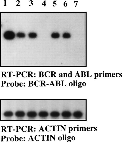 Fig. 5. Detection of the BCR-ABLp190 fusion gene product in the bone marrow of NOD/SCID mice with human Ph1-ALL grafts. / RT-PCR detection of the BCR-ABLp190fusion gene using specific primers for both human BCRand ABL genes in engrafted NOD/SCID mice with 105 cells (lane 1, patient No. 1; lane 2, patient No. 2; lane 3, patient No. 3; lane 5, patient No. 5; and lane 6, patient No. 6) and control NOD/SCID mice (lanes 4 and 7). The specificBCR-ABLp190 fusion gene product was identified by hybridization with a specific oligo spanning the gene fusion. The cDNA integrity was measured by hybridization of the RT-PCR product using actin-specific primers with an internal actin human primer.
