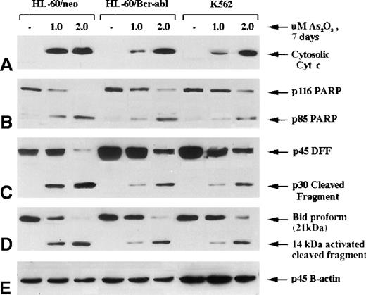 Fig. 3. Molecular events of apoptosis induced by As2O3 treatment. / HL-60 control (neo) and cells stably transfected with Bcr-Abl, as well as K562 cells, were treated with the indicated concentrations of As2O3 for 7 days; cells were then harvested for the following Western blot analyses: (A) cytosolic levels of cytochrome c; (B) full-length PARP (116 kd) and 1 of its cleaved fragments (85 kd); (C) DNA fragmentation factor (DFF45) and its cleaved intermediate fragment (30 kd); (D) Bid proform (21 kd) and its 14-kd-activated cleaved product.