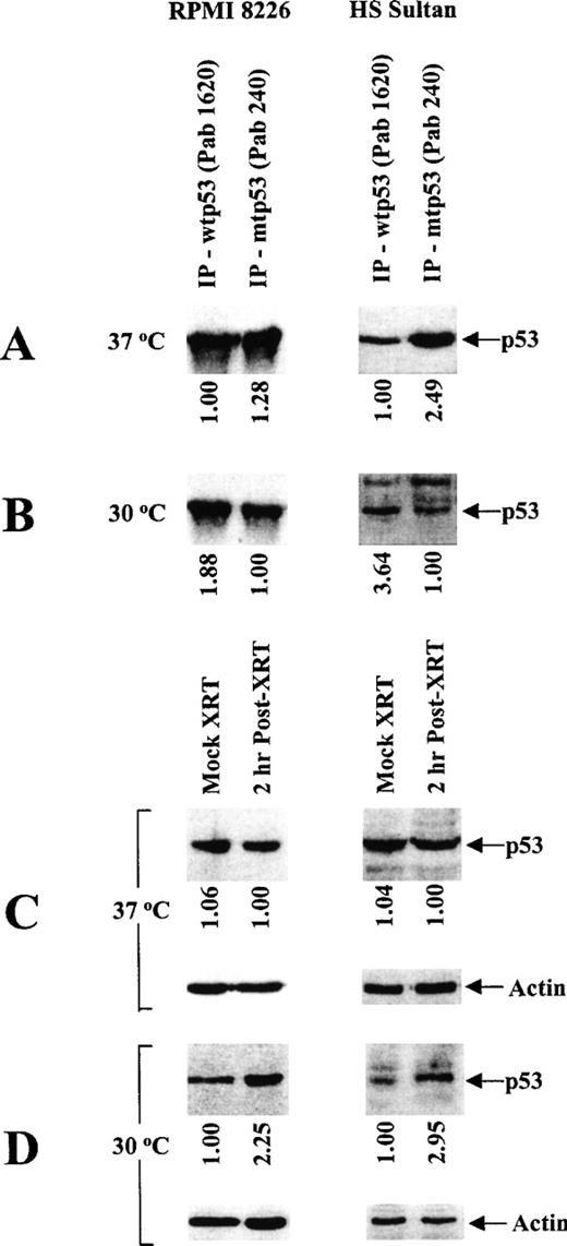 Fig. 1. Characterization of temperature-dependent p53 protein conformation in RPMI 8226 and HS Sultan MM cell lines. / RPMI 8226 and HS Sultan cells were cultured at 37°C (A, C) or 30°C (B, D). Total tumor cell lysates (1 mg/sample) were immunoprecipitated (10 μg) with either Ab-5 anti-wtp53 (Pab 1620) mAb or Ab-3 anti-mtp53 (Pab 240) mAb and immunoblotted (10 μg) with DO-1 HRP-conjugated anti-ptp53 mAb (A, B). Tumor cells were also mock- or γ-irradiated (2 cGy) and cultured at 37°C (C) or at 30°C (D) for 2 hours to induce wtp53 expression. Total cell lysates (30 μg/sample) of mock- or γ-irradiated tumor cells were resolved by SDS-PAGE and immunoblotted (10 μg) with DO-1 HRP-conjugated anti-ptp53 mAb or with Ab-1 anti-actin mAb.
