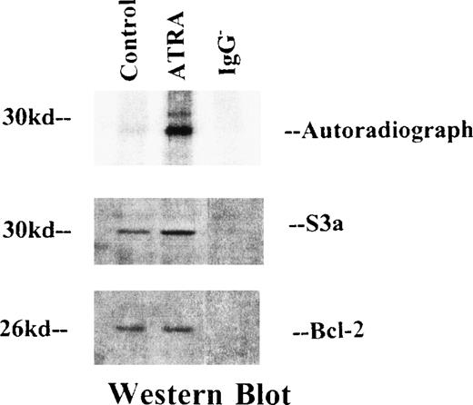 Fig. 2. OCI/AML-5 cells were labeled with32Pi and immunoprecipitated with anti-bcl-2 antibodies. / Immunoprecipitates were separated by SDS-PAGE electrophoresis. (top) Autoradio-graph of the gel, showing 2 bands of radiolabeled protein. (bottom) Western blots. The blot in the middle was stained for S3a and shows a band at the position of a 30-kd protein. The lower blot was stained with anti–bcl-2; it shows a band representing the 26-kd bcl-2.