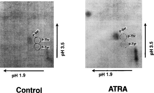 Fig. 3. Thin-layer chromatographs show phosphorylation of S3a on serine after the treatment of OCI/AML-5 cells with ATRA. / See description in text.